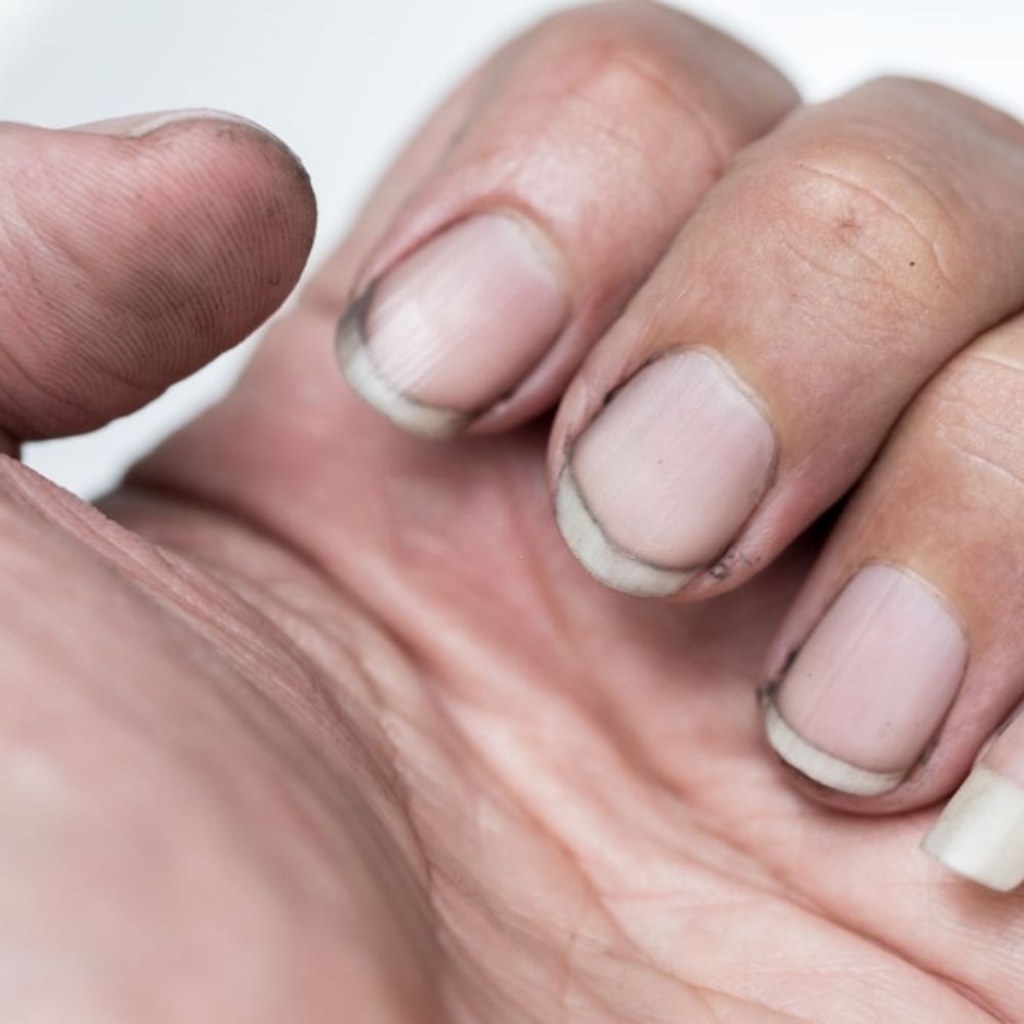 Picture of: Why Do I Always Have Dirt Under My Nails & How to Get Rid of It?